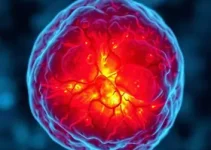 menina com tumor raro